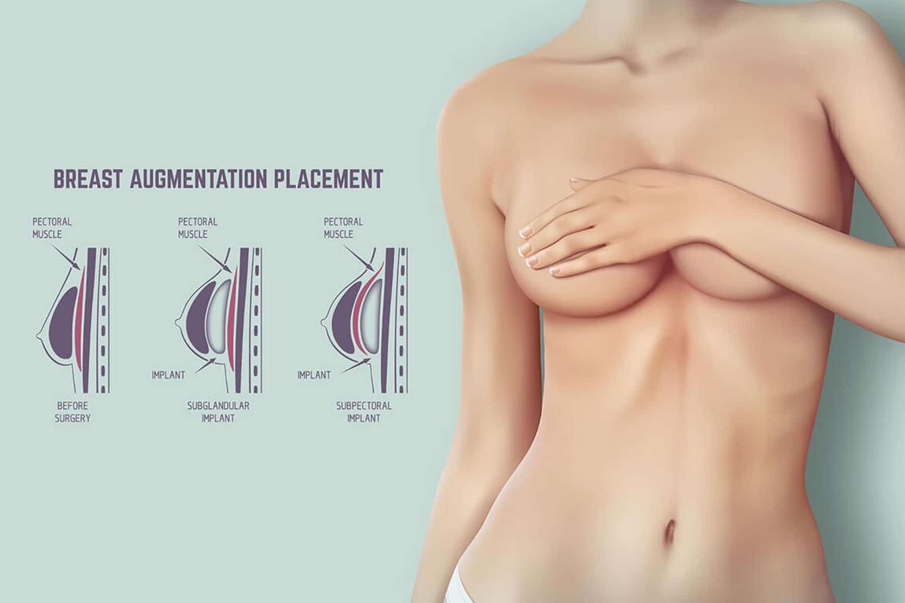 Breast Augmentation Packages