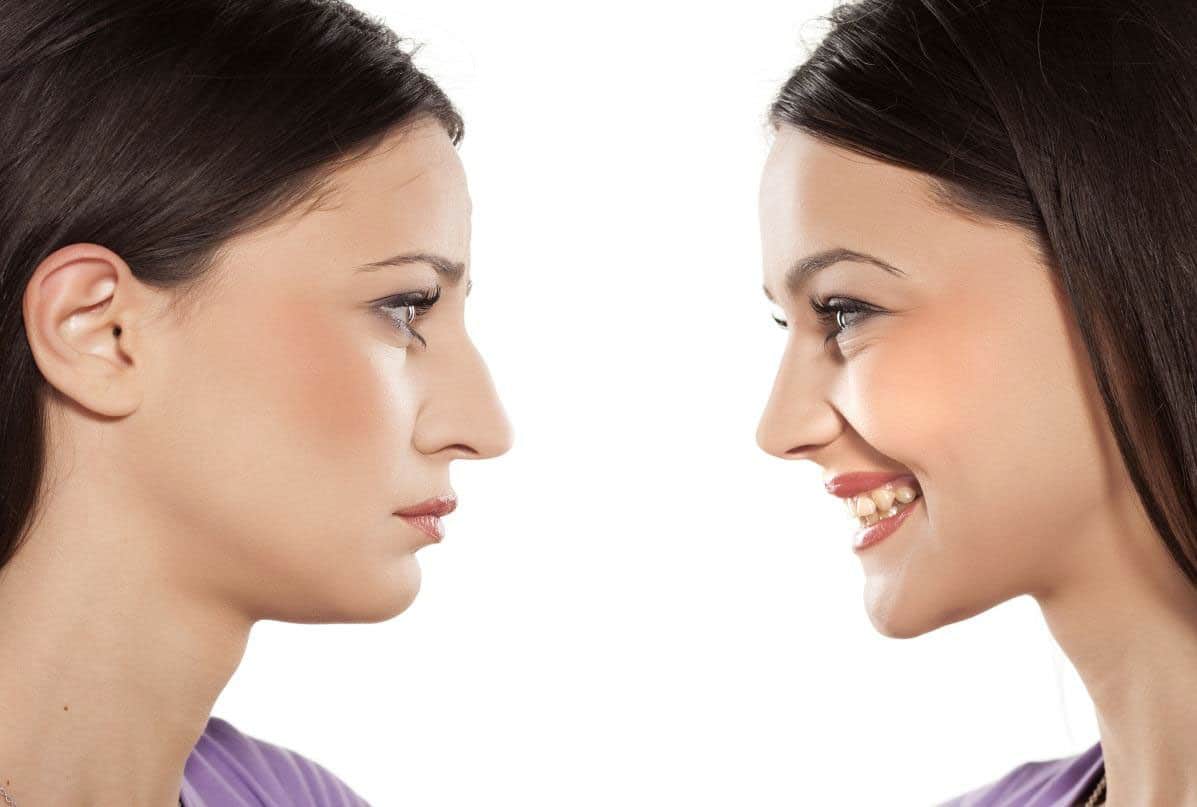 Rhinoplasty Packages (Nose Job)
